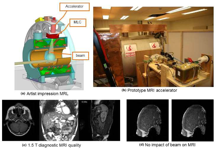 (a) 하늘색으로 표시된 낮은 자기장 토로이드를 가진 MRI 선형(MRL) 시스템의 개략도. (b) 실험 설정, (c) 진단 품질 이미징 및 (d) 빔으로 이미지 품질의 보존을 보여주는 돼지고기 절단 이미지.