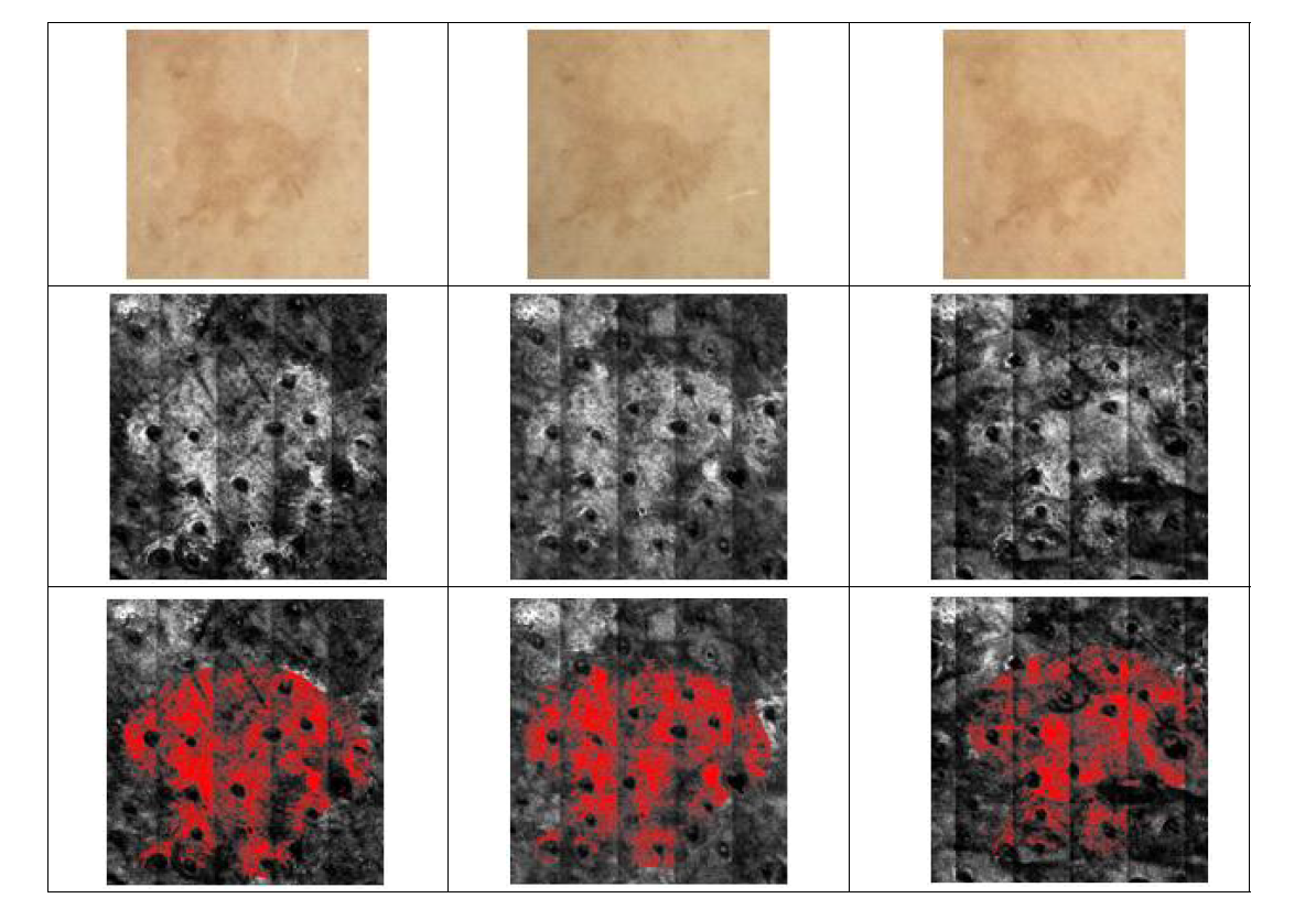 Changes of intensity of melanin on hyper-pigmented region following 4 consecutive weeks application of the test product (subject No. 02)