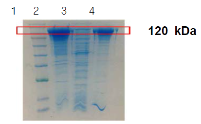 SDS-PAGE analysis of purified enzyme from each purification step