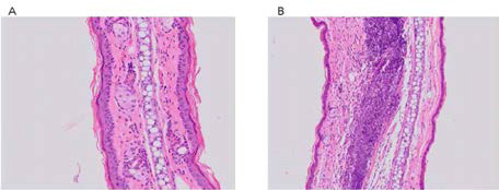 여드름균/phenanthrene으로 유도된 염증 동물 모델의 H&E 염색비교 A:PBS처리군(대조군) B:P.acnes/phenanthrene처리군(실험군)