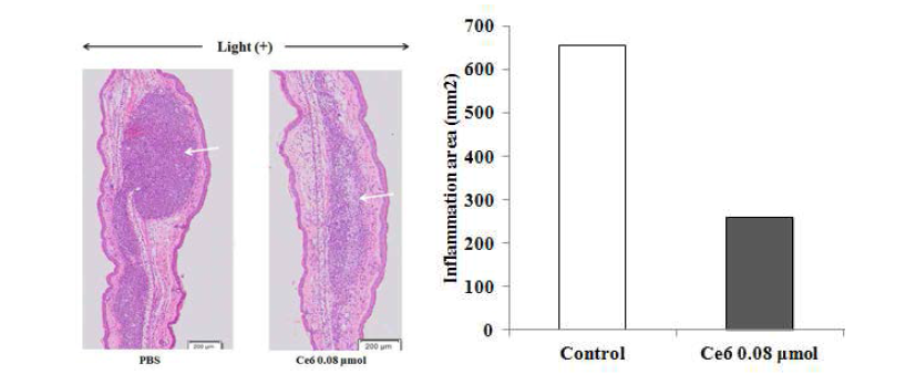 P. acnes/phenanthrene으로 유도된 여드름 동물 모델에서 클로린 e6 매개 PDT에 의한 여드름 염증 개선 효과