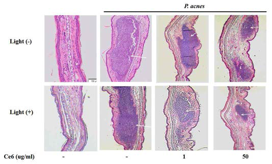 P. acnes으로 유도된 여드름 동물모델에서 클로린 e6 매개 PDT에 의한 여드름 염증개선 효과