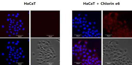 HaCaT 세포에 의한 클로린 e6의 세포의 uptake