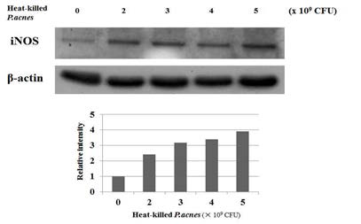 Heat-killed P. acnes에 의한 HaCaT 세포의 염증 유도 확인