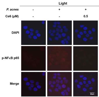 면역형광염색을 통한 염증 유발 HaCaT 세포에서 클로린 e6 매개 PDT의 NF-ĸB 단백질 발현 분석