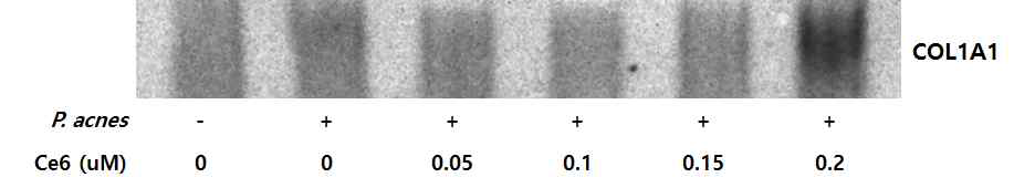 Western blot을 통한 클로린 e6 매개 PDT에 의한 HaCaT 세포의 pro-collagen type I (COL1A1) 합성량 증가.