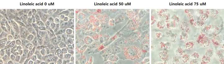 피지분비세포와 각질형성세포 공생배양 및 linoleic acid 처리 후 Oil-Red-O 염색을 통한 지방합성량 관찰.
