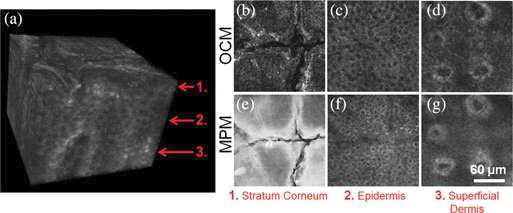 OCT와 MPM가 결합된 시스템을 이용한 사람의 피부 이미지.