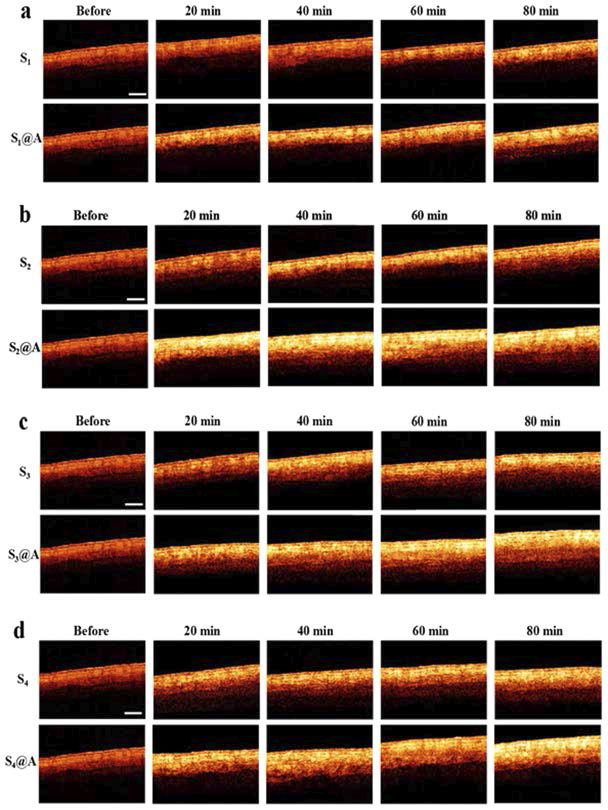 human skin에 서로 다른 농도의 SA와 azone 결합물질의 처리 전/후에 대한 OCT 이미지.