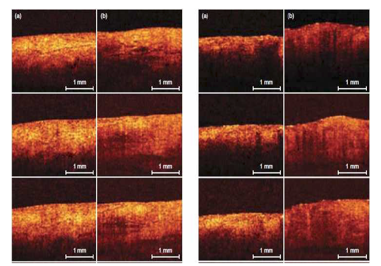 60% 글리세롤의 흡수도 변화의 OCT 영상