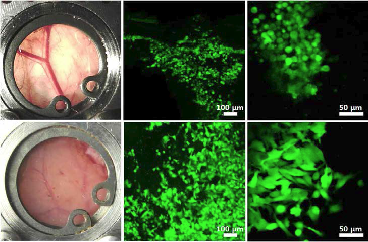 피부조직 영상화를 위한 개량형 영상챔버 적용 사진 및 녹색 형광표지세포의 피부조직 생착 이미징 결과.