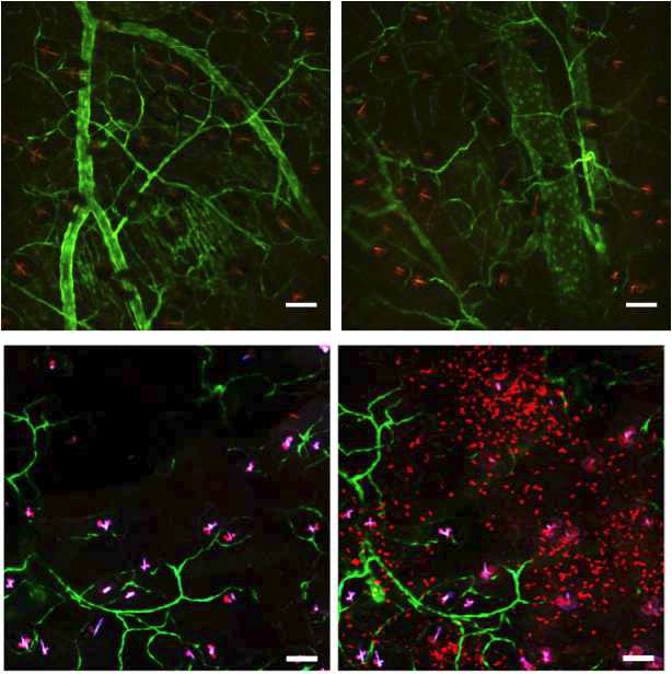 Tie-2-GFP 생쥐의 피부조직 내 혈관 및 면역세포 형광영상