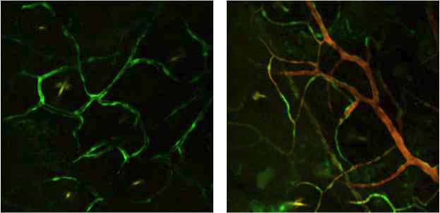 VE-Cadherine 유전자변형 생쥐 피부조직 내 혈관의 형광영상 결과