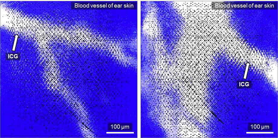 근적외선 대역 기반 초소형 공초점 내시경 광학계 기반 ICG로 표지한 생체 내 혈관의 영상화 결과