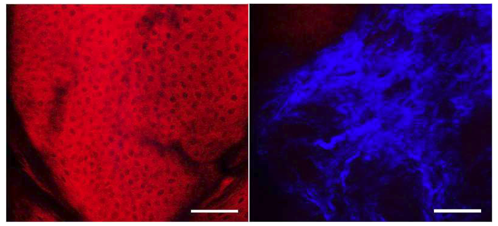 이광자 현미경으로 측정한 돼지 피부의 표피층에 분포하는 Rhodamine B 형광 신호(왼쪽)와 진피층 collagen 분포의 비선형 광학 영상