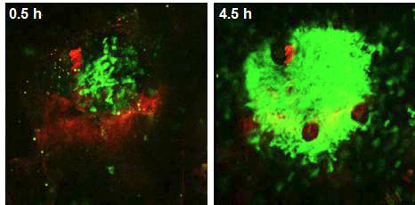 LysM-GFP 마우스에 주사한 pro-inflammatory 단백질 주변 (적색)으로 호중구 및 대식 세포 (녹색)가 모여든 모습의 영상화