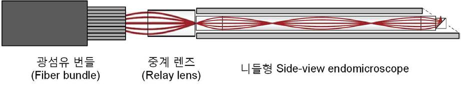 광섬유 번들과 중계 렌즈, 니들형 초소형 side-view endomicroscope의 결합 구성도