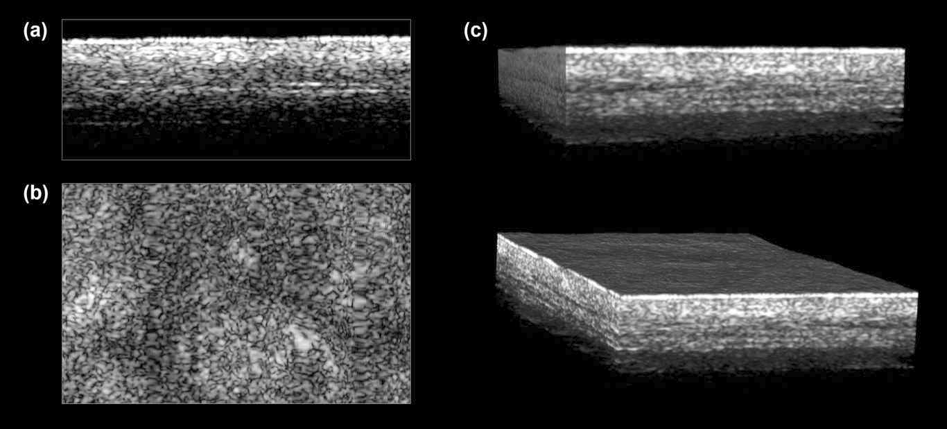 기능성 물질을 피부 조직에 도포 후 촬영한 optical coherence tomography (OCT) 이미지