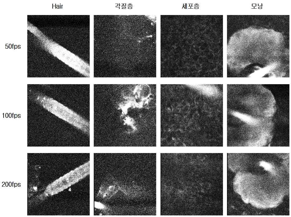 각각의 영상속도에서 Two-photon 현미경으로 관찰한 in vivo mouse의 피부조직