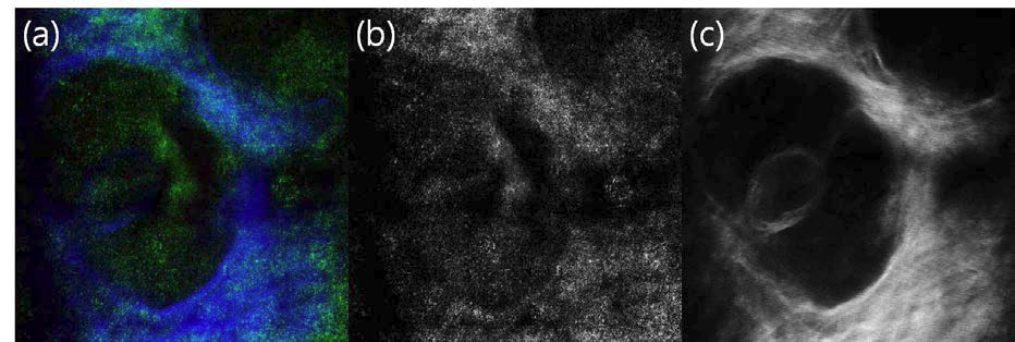 (a) 532 nm laser reflection 이미지 (녹색)와 730 nm laser에 의한 2-photon 이미지 (청색) (b) 532 nm reflection 이미지, (c) 730 nm laser에 의한 2-photon 이미지