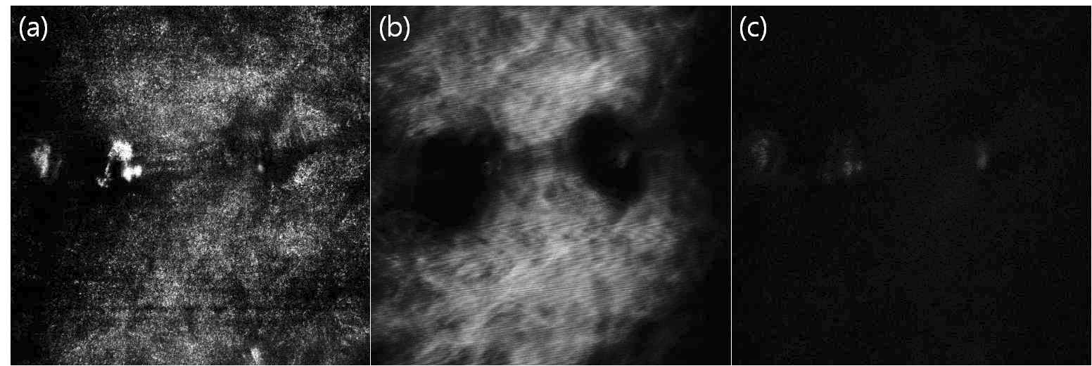 (a) 532 nm 반사이미지, (b) 730 nm 2-photon 자발 형광 이미지, (c) 600 nm nile red emission 이미지