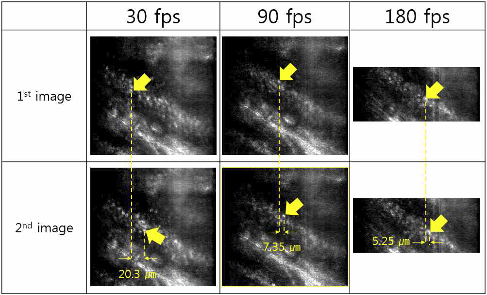 영상속도가 다른 혈류 영상의 연속이미지와 1 프레임동안 혈구가 이동한 거리 비교