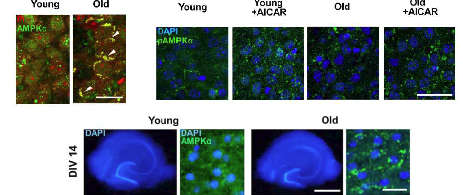 노령 쥐에서 AMPK 반응성 저하에 대한 원인을 규명하고자 진행한 연구에서 조직 염색상 노령 생쥐의 해마조직에서는 AMPK가 핵주변에 inclusion을 이룬다는 사실을 확인하여, 이 현상이 AMPK 반응성 저하의 원인으로 주목됨