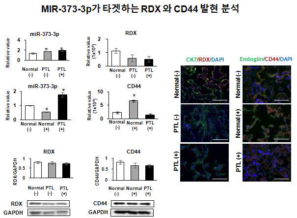 마이크로RNA-373-3p가 타겟하는 RDX 와 CD44 발현 분석
