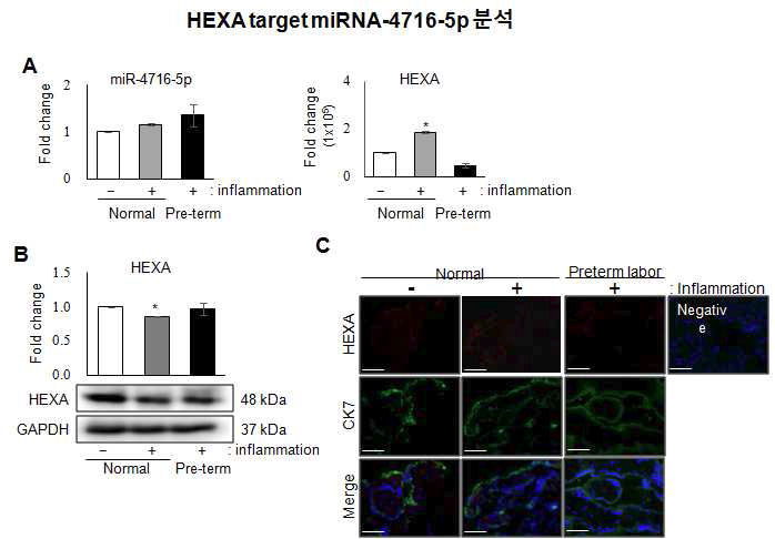 마이크로RNA-4715-5p에 의해 조절되는 HEXA 발현 분석