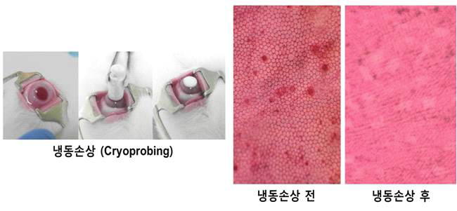 가토의 각막내피 냉동 손상 이후, 손상 전과 대비해 육각형 모양의 각막내피세포가 모두 소실된 것을 확인할 수 있음.