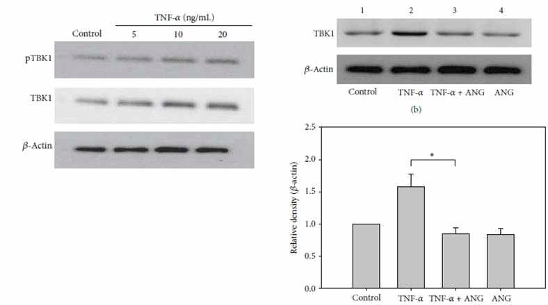 염증성 각막섬유모세포에서 angiogenin에 의한 TBK1 단백발현감소에 관한 Western blot 분석.