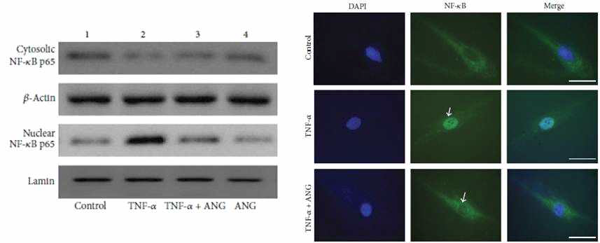 TNF-α 유도 염증성 각막 섬유모세포에서 angiogenin 처리 전후의 핵 및 세포질 내 NF-kB 단백의 발현 변화 양상에 관한 Western blot 분석 (좌) 및 세포면역형광염색 소견 (우).