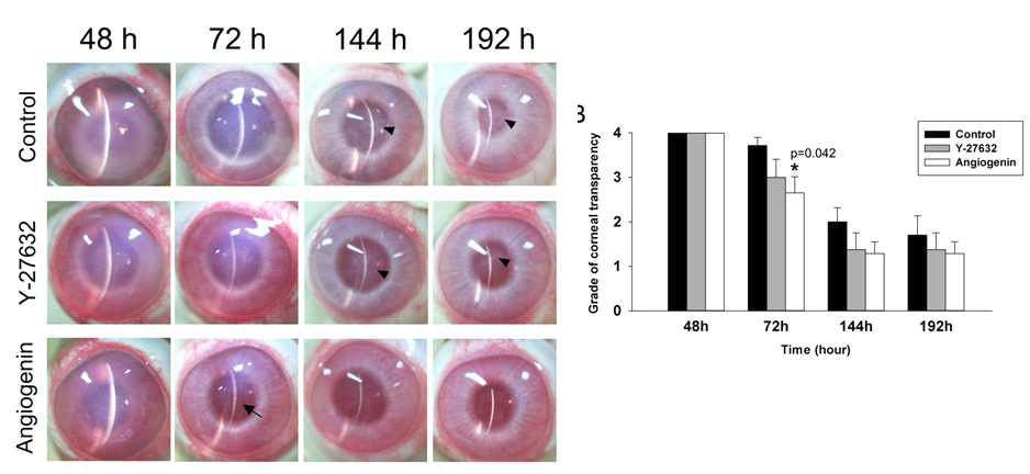 가토의 각막내피 손상모델에서 angiogenin의 각막 투명도 호전 효과.