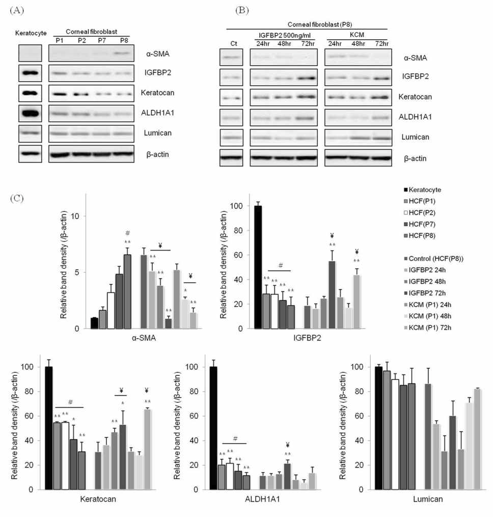 각막섬유화세포에서 KCM과 IGFBP2 처리 시 관련인자 발현 양상