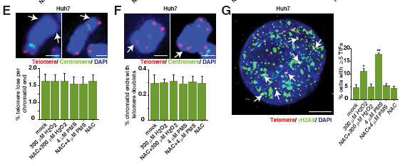 ROS 처리 후 HCC cell에서 chromosome end-fusion이나 telomere doublet같은 극심한 telomeric damage의 빈도는 대조군과 큰 차이가 없었음.