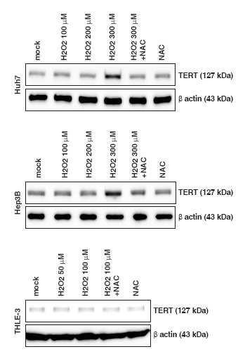 ROS처리 후 Immunoblot assay로 TERT expression 확인함.