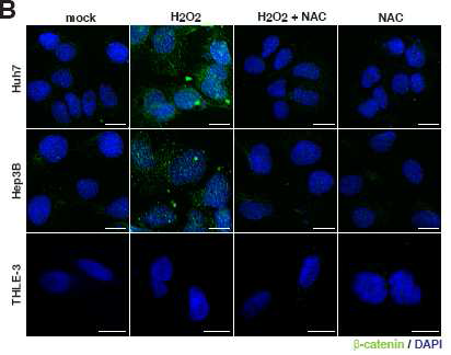 ROS 처리 후 β-catenin의 발현량 확인함.