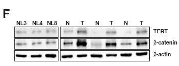 HCC cell에서 TERT와 β-catenin에 대한 immunoblotting을 수행함.
