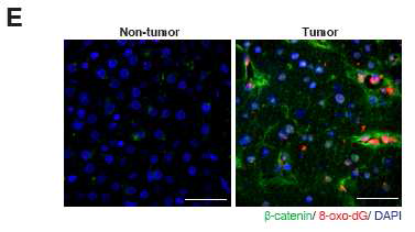 HCC cell에서 ROS level과 β-catenin expression 측정을 하기 위하여 immunostaining을 수행함.