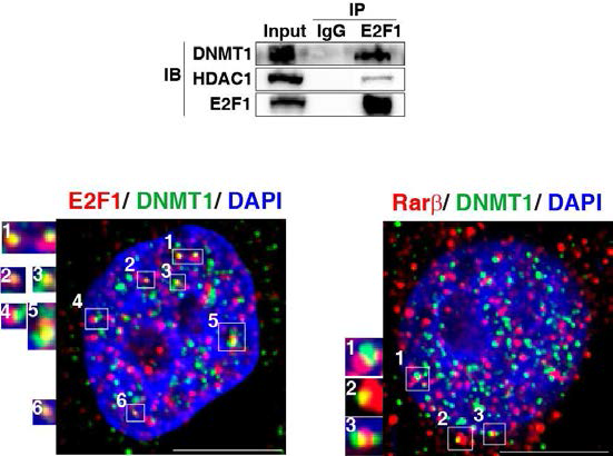 DNMT1과 E2F1이나 Rarβ와의 co-immunoprecipitation (위) 과 co-staining (아래) 그림