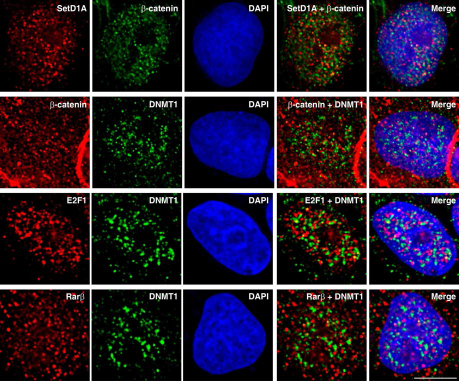 SetD1A, β-catenin, E2F1, Rarβ, DNMT1의 세포내 발현 양상