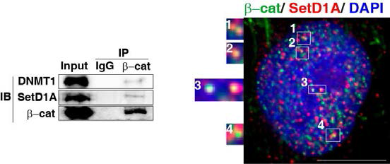 DNMT1과 β-catenin과의 co-immunoprecipitation (왼쪽) 과 co-staining (오른쪽) 그림