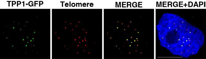 TPP1-GFP stable cell line 구축