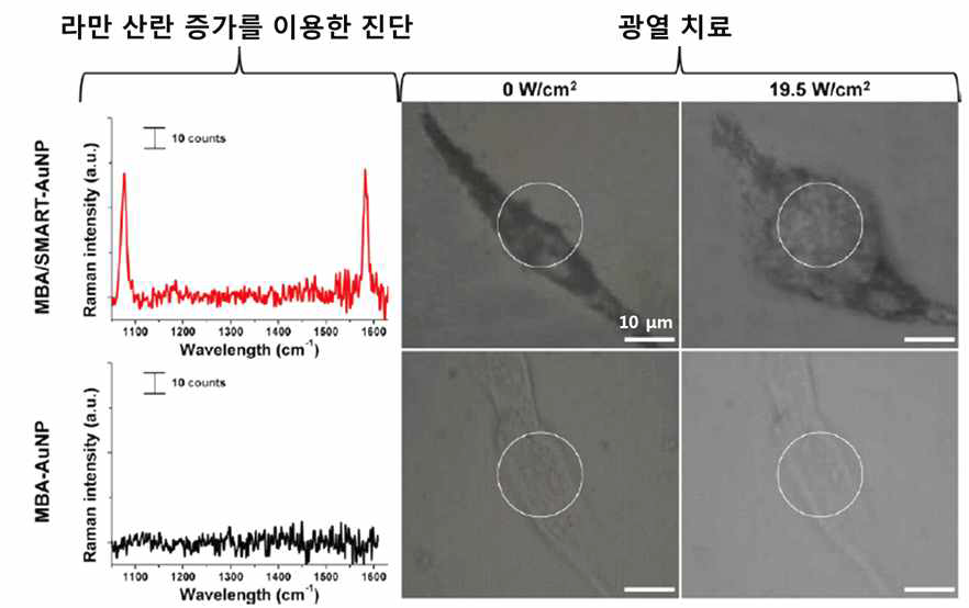 4-MBA가 도입된 지능형 금 나노 입자를 이용한 암세포 진단 및 광열 치료.