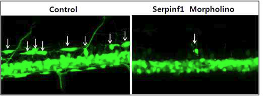 희소돌기아교세포 특이적으로 녹색형광을 발현하는 olig2:EGFP transgenic 제브라피쉬의 배아에 serpinf1 MO를 미세주입 한 결과, 척추신경계에서 dorsal로 이동한 분화된 희소돌기아교세포(arrow)가 크게 감소되어 있음을 확인하였음.