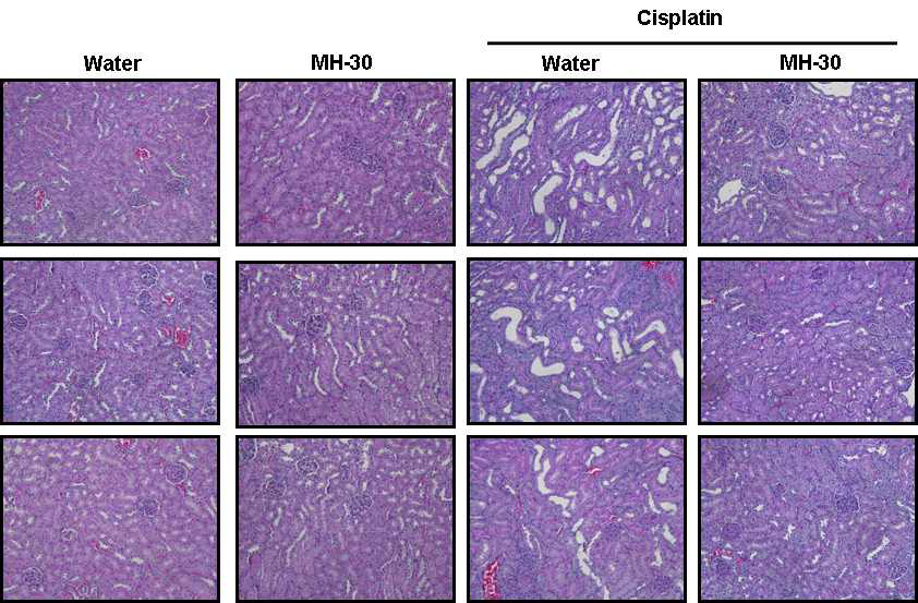 항암제(Cisplatin) 부작용 동물모델에서 신장 독성에 대한 MH-30의 경감 효과 (조직화학분석).