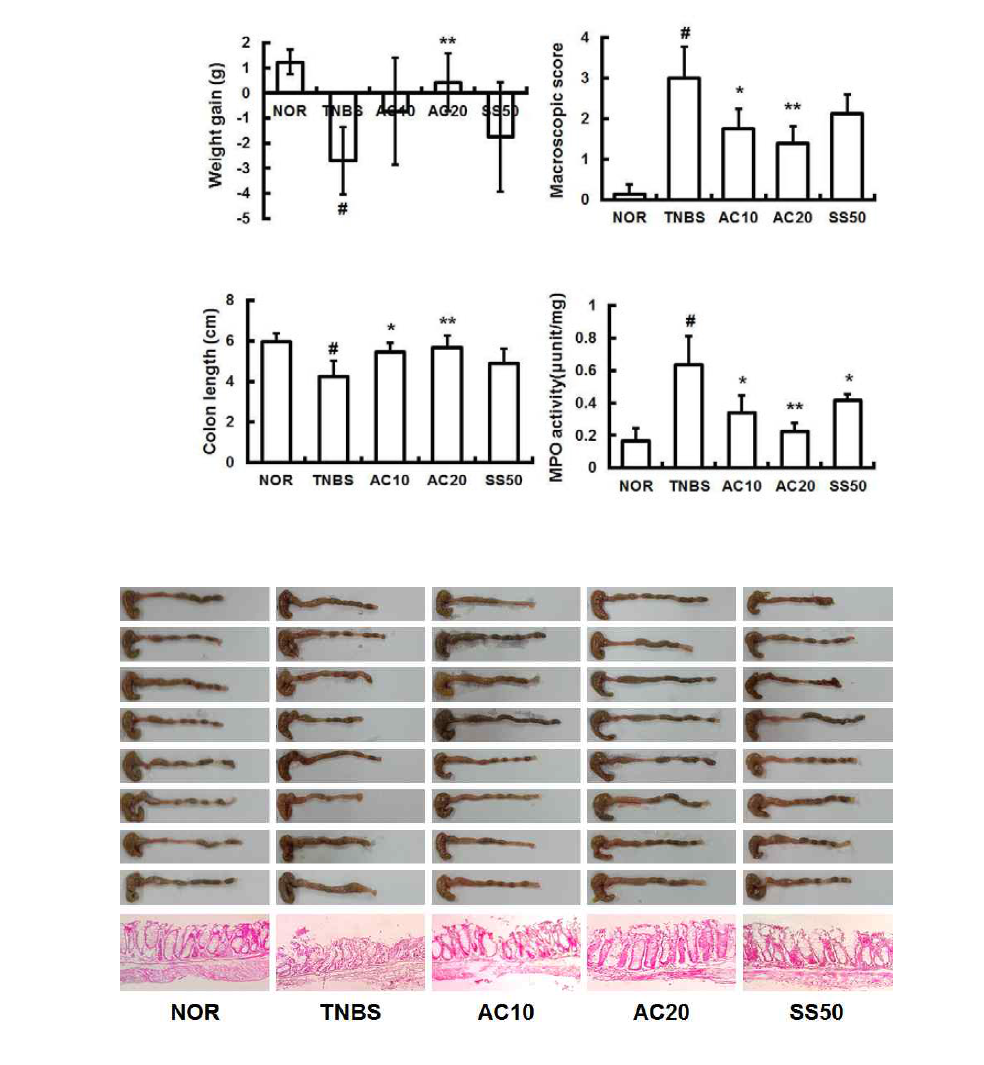 Anti-inflammatory effect of DWac in C57/BL6 mice with TNBS-induced colitis.