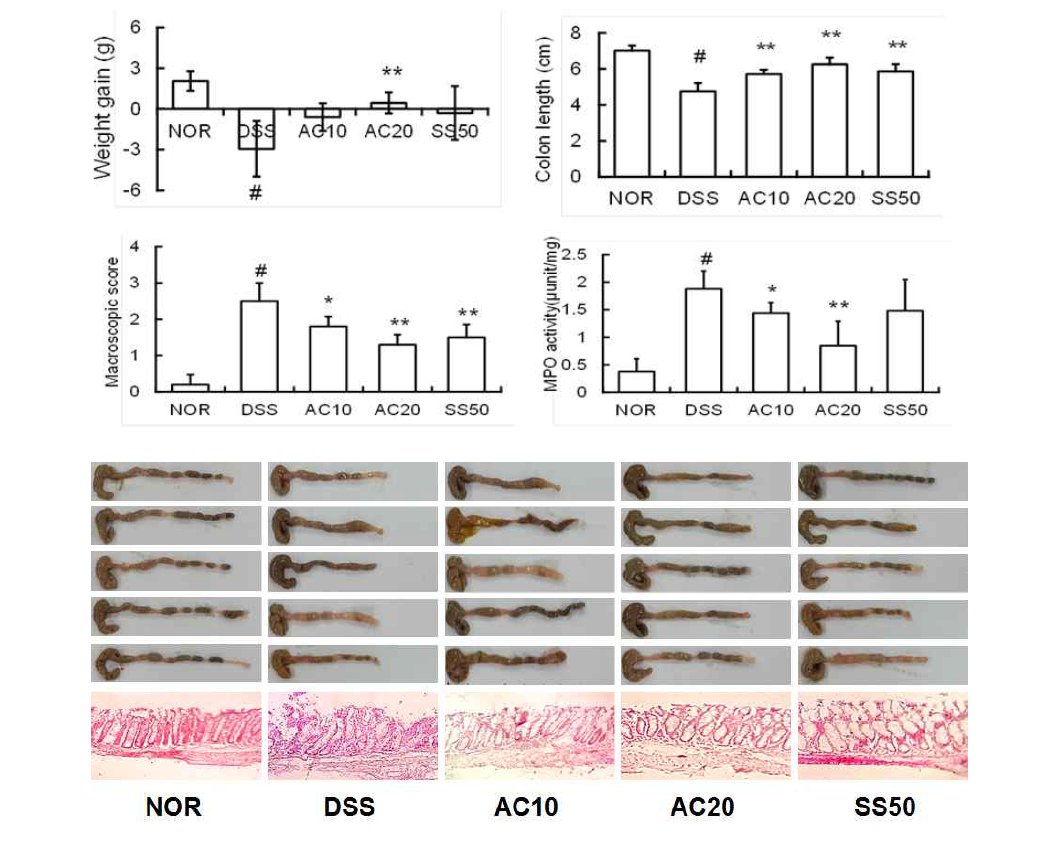 Anti-inflammatory effect of DWac in mice with DSS-induced acute colitis.