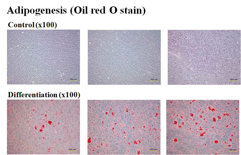 골수유래 중간엽줄기세포의 Adipogenesis 확인