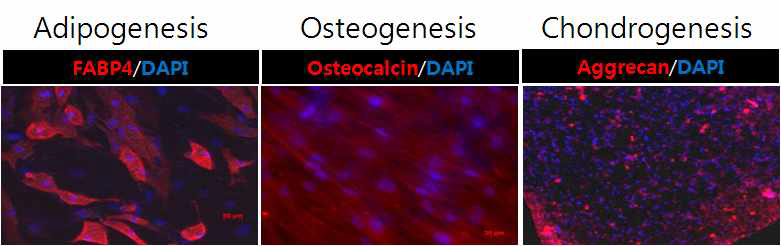 STAT3 억제된 중간엽줄기세포의 정상적 multipotency 확인